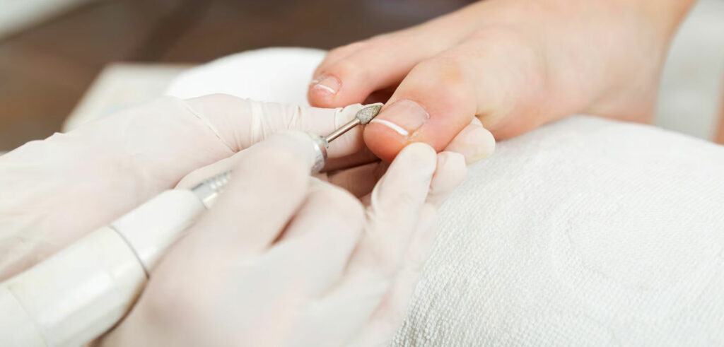 Protocolo de éxito: Cómo aplicar el tratamiento